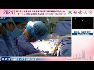 Transvaginal Microwave Ablaiton for Uterine Adenomyosis