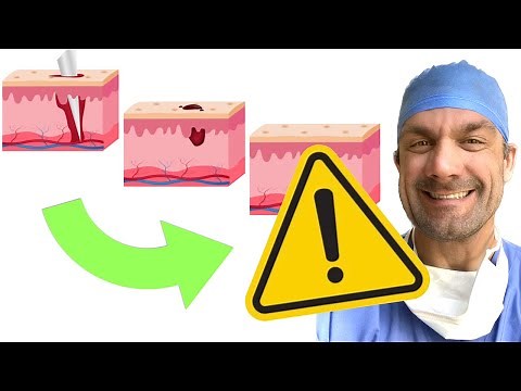 Why isn’t the Wound Healing? It’s NOT the wound!