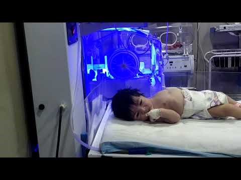 Why Do Newborn Babies Have Infantile Spasms? | Causes & Warning Signs 👶🧠#neurologist #newbornbaby #