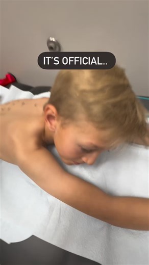 1M views · 3.2K reactions | It’s gotten worse from last time. This boy is very allergic to peanuts. His allergy is too severe for OIT or SLIT treatment which are designed to expose kids to tiny amounts of peanuts as a desensitization. It’s scary that something so small can be so deadly. #allergies #foodallergies #peanutallergy | Love For Luke | Facebook