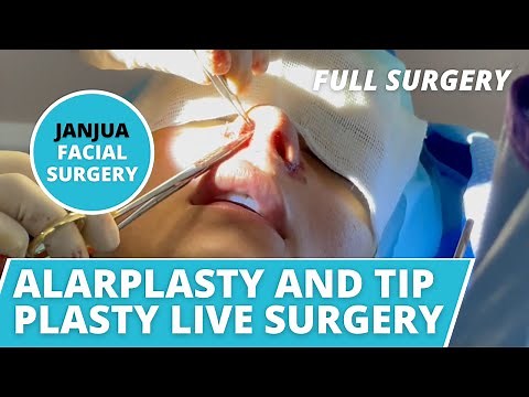NOSE JOB LIVE SURGERY (ALARPLASTY AND TIP PLASTY) - DR. TANVEER JANJUA - NEW JERSEY