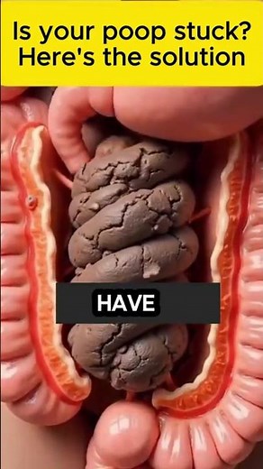 Natural Remedy to Eliminate Stuck Poop!