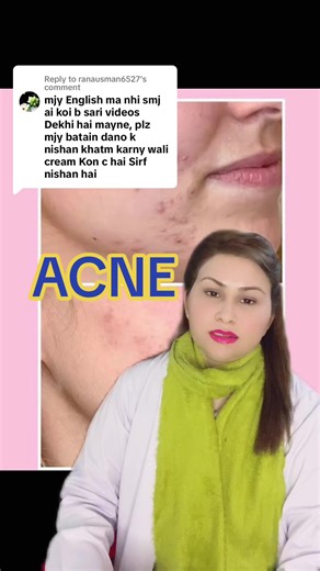 Comprehensive Guide to Effective Acne Treatments
