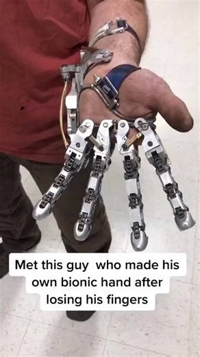 This guy made his own bionic hand!🦾 What used to cost tens of thousands of dollars in a medical lab is now being built in home workshops. This custom bionic hand is a testament to the democratization of Prosthetic Engineering. Technological Enablers: - 3D Printing: Allowing for rapid prototyping and personalized ergonomic fitting at a fraction of the cost. - Myoelectric Sensors: Detecting micro-voltages from muscle movements to trigger precise finger actuation. - Affordability: Turning a high-e