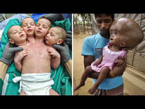 15 Unusual Babies You Wont Believe Actually Exist
