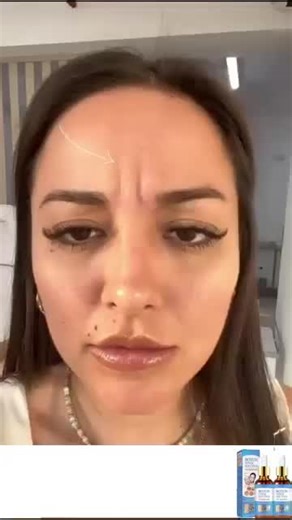 Botox Stock Solution on TikTok