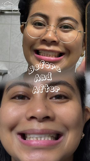 Euthymol Whitening Toothpaste for Bright Smiles