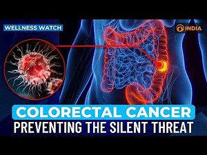 Colorectal Cancer: Preventing the silent threat | Wellness Watch