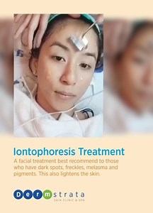 1.9K views · 30 reactions | Even out that skin with Iontophoresis Treatment! | Dermstrata Skin Clinic | Facebook