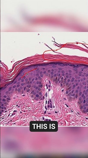 Keratin Flakes & Skin Protection | Skin Under the Microscope