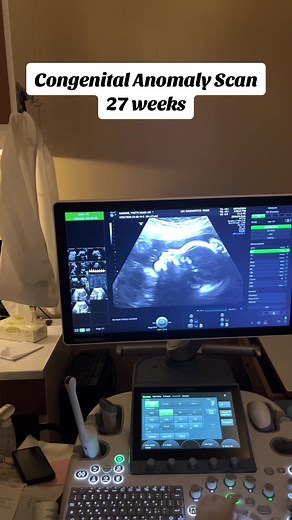 27 Weeks Pregnant Congenital Anomaly Scan
