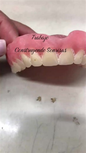 Building Smiles at Shield Dental Lab