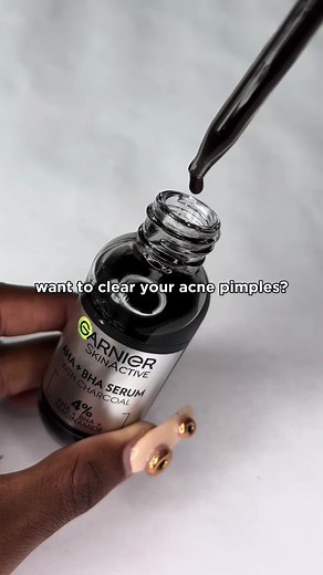 Effective Acne Treatment with Garnier Products