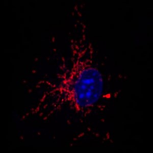 Immune System Conserves Energy By Altering Metabolism | Immunology