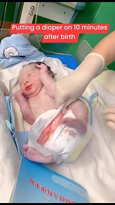 142K views · 1.4K reactions | Putting a diaper on 10 minutes after birth | I Love Newborn | Facebook