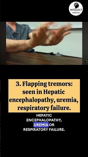 10 Important abnormal movements (imp for exams) #neurology #neetpg #internalmedicine