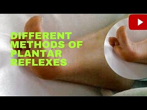 Plantar reflex, Chaddock method, Oppenheim method, Gordon, Schaefer