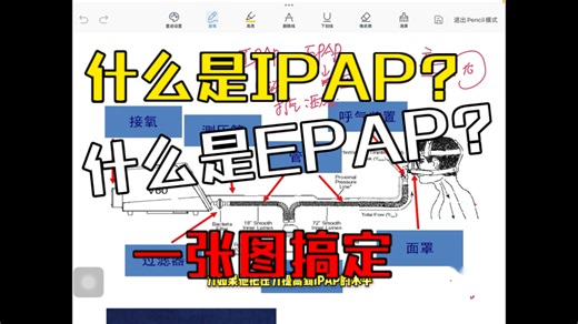 粉丝提问:什么是IPAP？什么是EPAP?一张图给你讲透彻