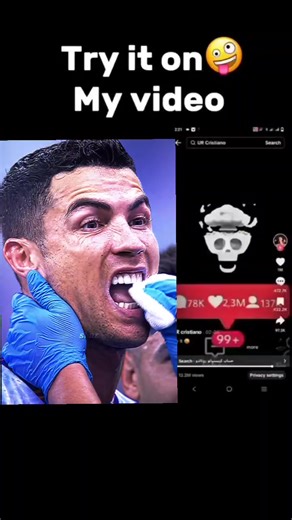 Ronaldo Injured: What Happened?