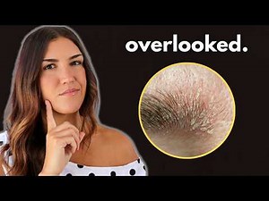 7 signs you're low in iodine