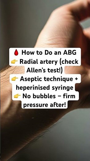 Learn how to perform an ABG (Arterial Blood Gas) quickly and effectively! 🩺 #theneurodoctor