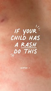 221K views · 1.6K reactions | We have a wall of little lives saved...