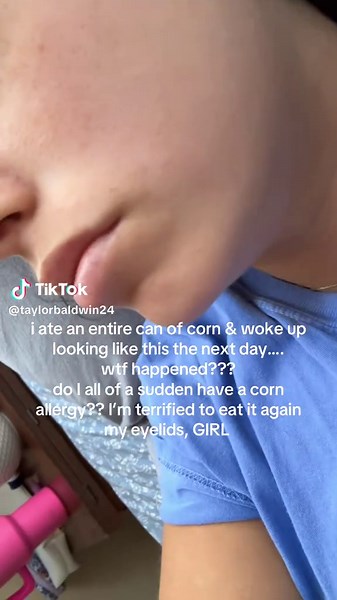 Understanding Corn Allergies: Symptoms and Reactions