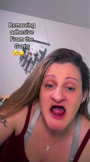 Removing Adhesive From Gums for Denture Confidence