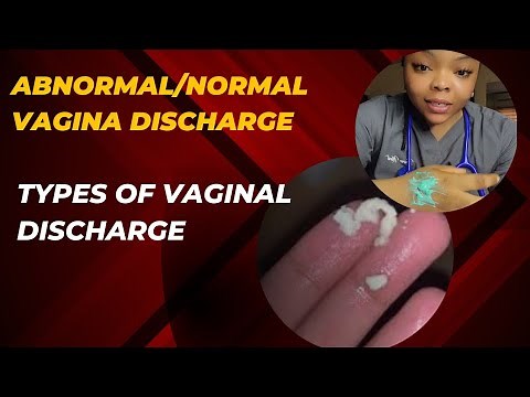 What a Normal and abnormal vaginal discharge looks like and what to do