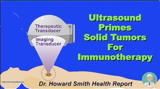Ultrasound Primes Solid Tumors For Immunotherapy The advent of CAR-T cell therapy has revolutionized the oncologic management of blood cell cancers that readily display their tumor-specific antigens. Solid cancerous tumors that grow in major organs including the breast, lungs, and the liver are so closely packed that their tumor-specific markers are hidden preventing the modified T killer cells from attacking them. For this reason CAR-T strategies have been ineffective. University of Southern Ca