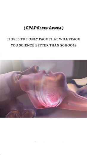 😴 How CPAP Helps in Sleep Apnea — Breathing Restored at Night