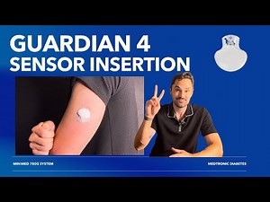 Medtronic Guardian 4 sensor insertion - How to Insert The Guardian 4 sensor