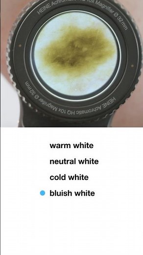 HEINE DELTA 30 PRO - colorSHIFT function