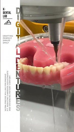 the perfect smile starts with digital dentures #digitaldenture #digitaldentistry #kdentallab