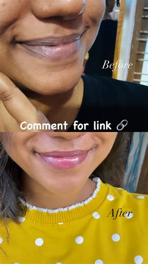 akkuuhh on Instagram: "Comment “LINK” to get your product link 🔗 . . . . . #skincare #darklips #lipbalm #instagram #reels #skincareproducts #skincarecommunity #results #youthface #youthfaceindia #skincare #trendingnow ##foryou #fypage #keralablogger #explorepage✨ #fyp"