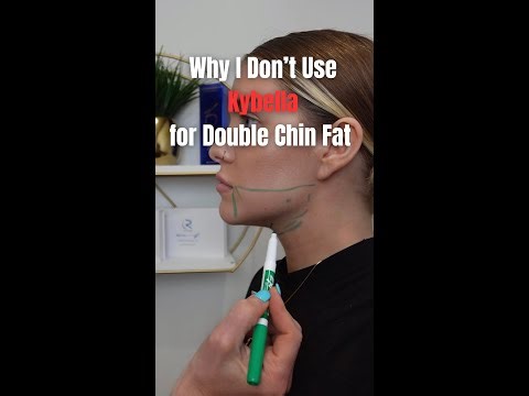 Why I Don’t Use Kybella for Double Chin Fat | Better Options