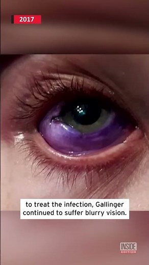 Eyeball Tattoo Led to Serious Infection #shorts