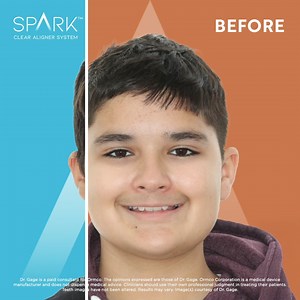 11 reactions | What was the secret to transforming this Class II Deep...