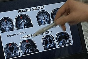 Scientists ‘talk’ to coma patient