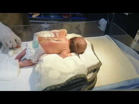 MMC Baby Dressing Change After Surgery | Safe & Gentle Care