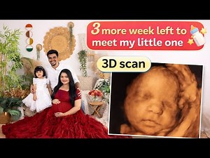 3d scan 👶🏻🤰🏻done delivery date fix ಆಯಿತು 🤷🏻‍♀️ 3 more week left to meet my little one 🐣#kannadavlogs