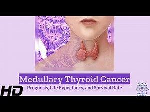 Navigating Medullary Thyroid Cancer: Prognosis Unveiled
