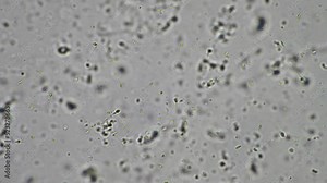 Sperm under the microscope. Looking a semen swimming. Healthy fertile man high sperm count