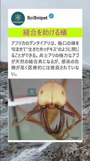 縫合を助ける蟻