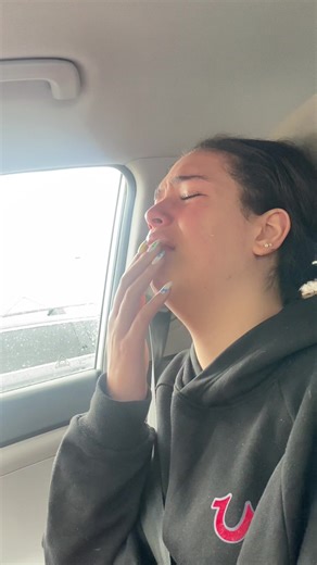 After the Wisdom teeth extraction@