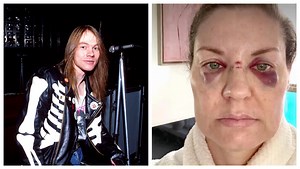 Guns N' Roses Axl Rose Throws Mic Into Crowd, Nails Woman In Face