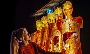 Already a global hit, the Body Worlds Rx exhibit heads to Science Museum