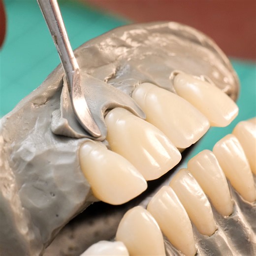 DIY Headphone Case with Fossilized Teeth! 📱🦷 | Transformazing