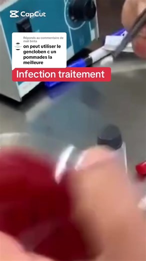 Infection Traitement et Prévention pour Femmes