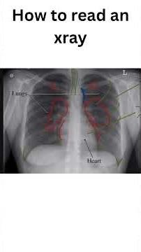 How to read an xray